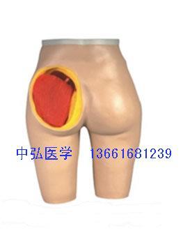 供应臀部肌肉注射与解剖结构模型、臀部注射与肌肉解剖模型 