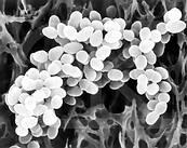 银离子无机抗菌剂纳米银抗菌整理剂批发