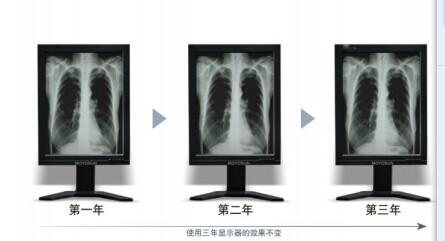 供应北京魔言1MP灰阶显示器，CT显示器，X光机显示器，