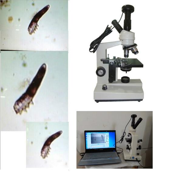 供应美容螨虫检测仪器显微镜/700/新怡图片